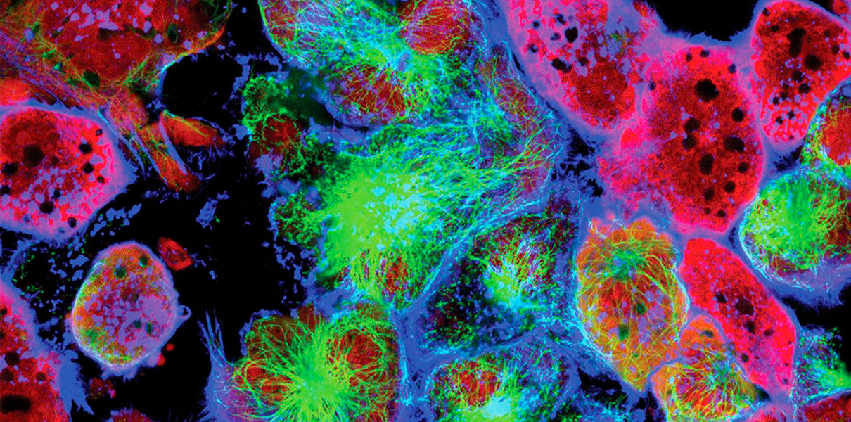 Японские ученые определяют 13 типов рака по одной капле крови