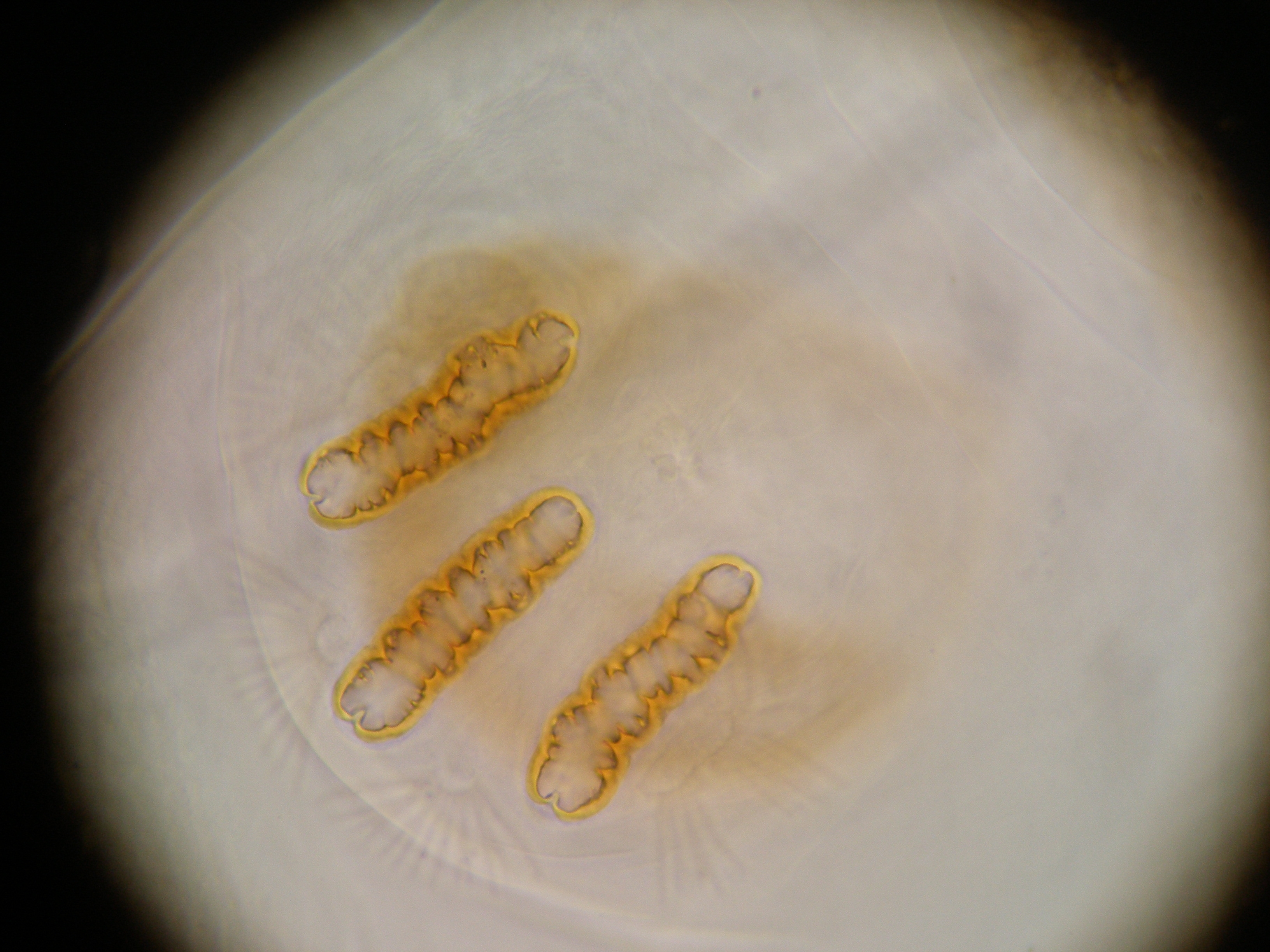 Внимательно покупайте экзотические фрукты