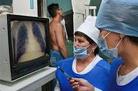 Установлено ограничение на выполнение ряда работ для лиц с подозрением на туберкулез Установлено ограничение на выполнение ряда работ для лиц с подозрением на туберкулез