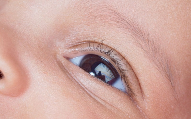 В РФ удаленная диагностика ретинопатии недоношенных не уступает очному приему