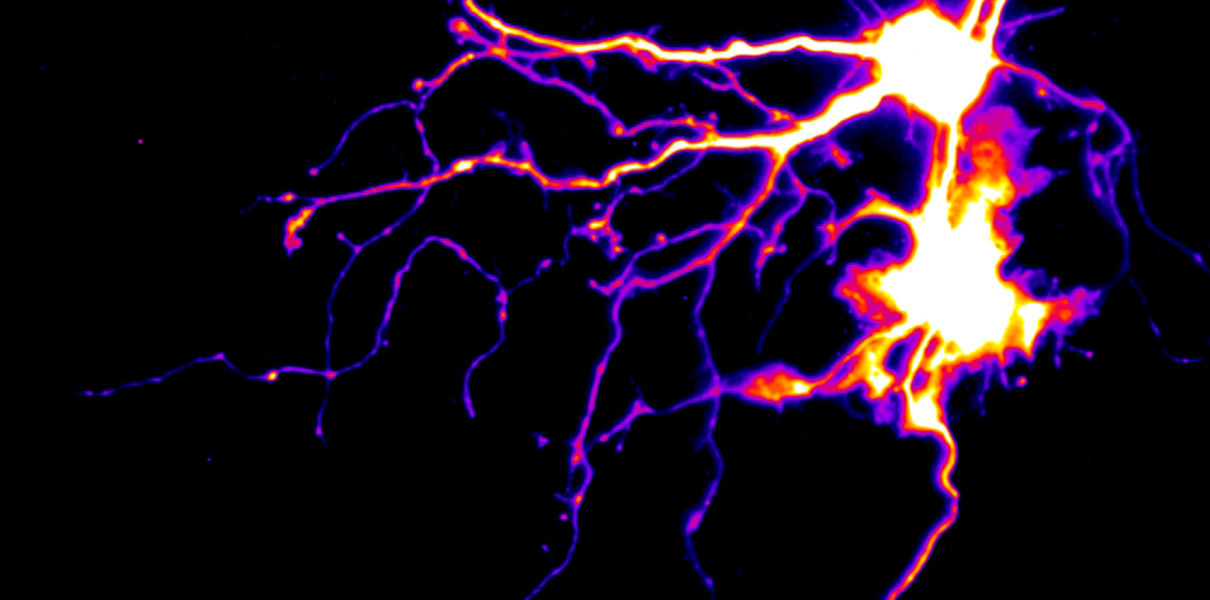 Открытие ученых позволит «перепрошить» мозг после инсульта Открытие ученых позволит «перепрошить» мозг после инсульта