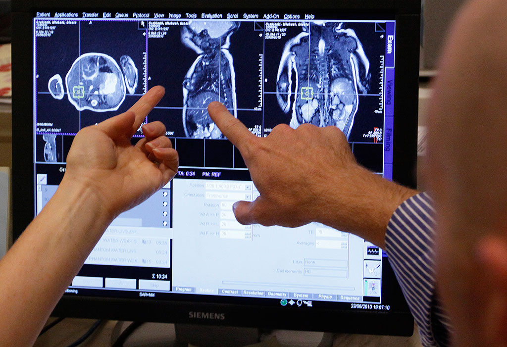 Медики научились предсказывать дату смерти человека