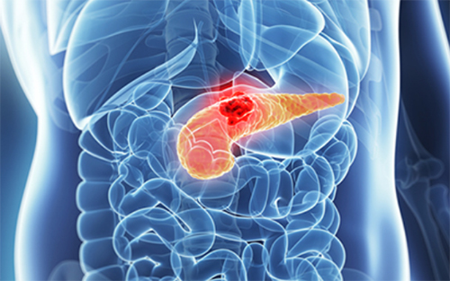 Перепрограммирование биологических систем поможет бороться с раком