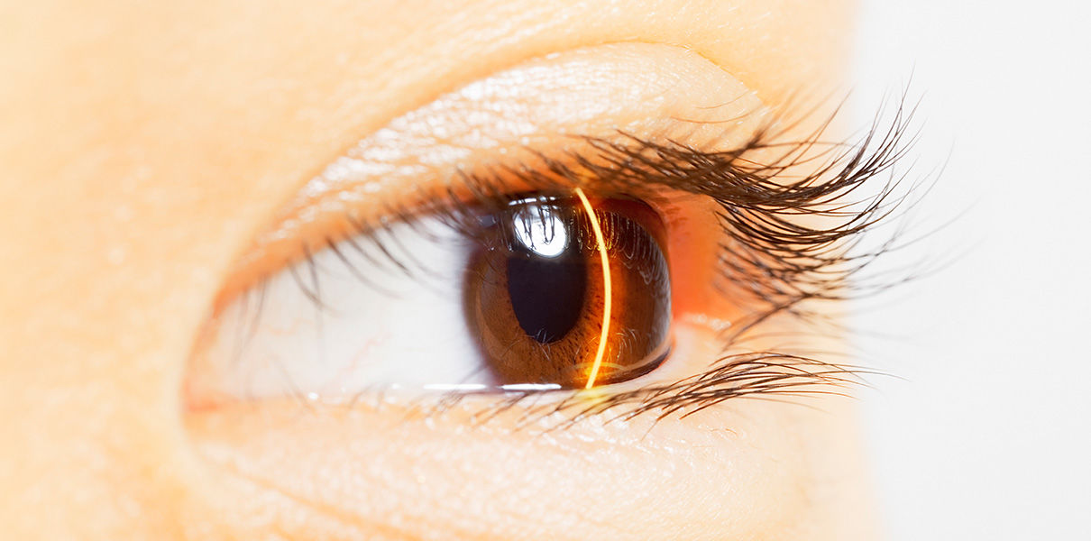 Новый метод сканирования сетчатки поможет выявить диабет