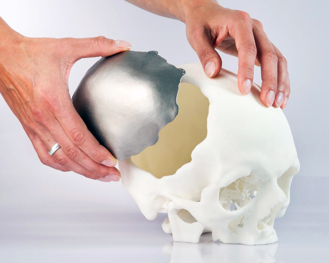 3D-печать в медицине