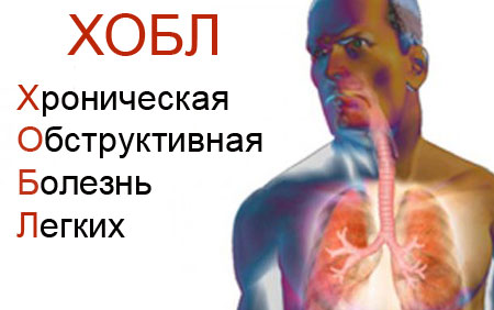 Хроническая обструктивная болезнь легких (ХОБЛ)