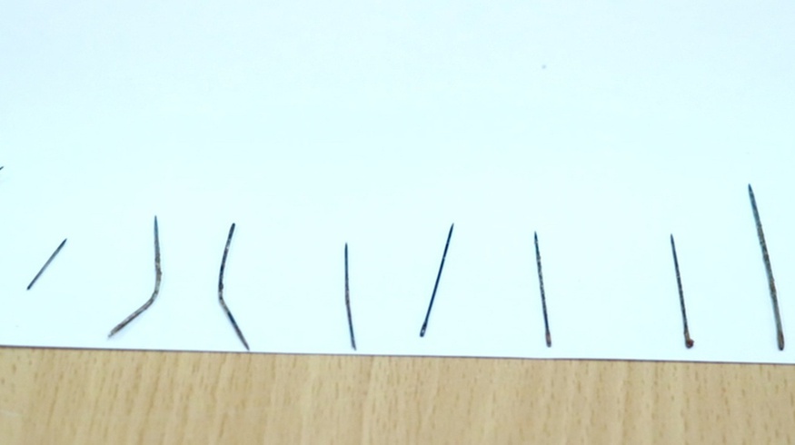 Генпрокуратура дала официальное заявление по факту 16 иголок в теле малыша Генпрокуратура дала официальное заявление по факту 16 иголок в теле малыша