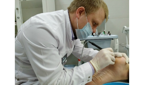 Бородавки и родинки - удалять или нет?