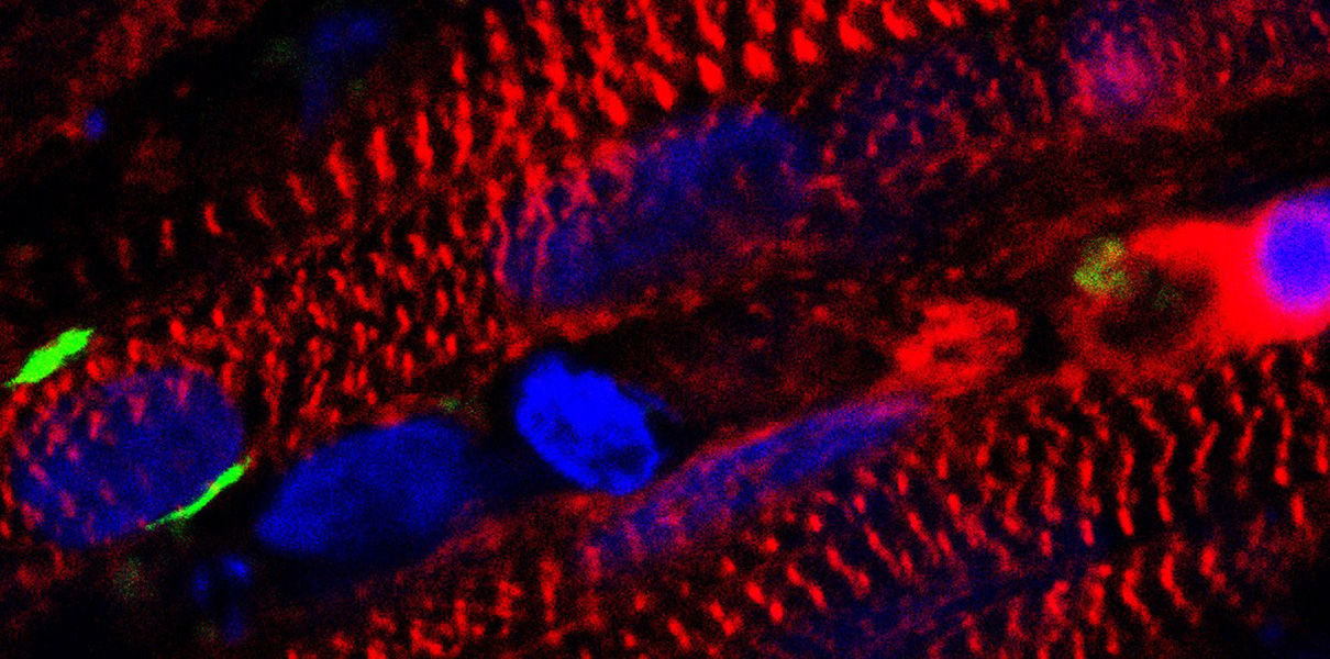 Ученые вырастили мышцу из клеток кожи
