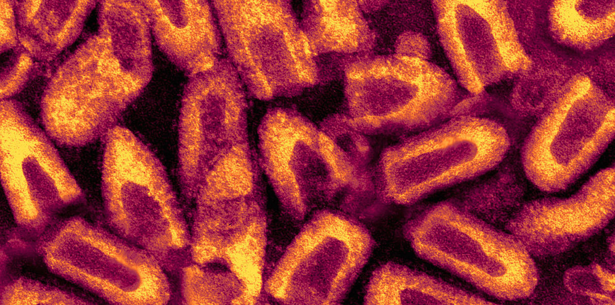 Ученые стали лучше понимать, как вирусы вызывают инфекции