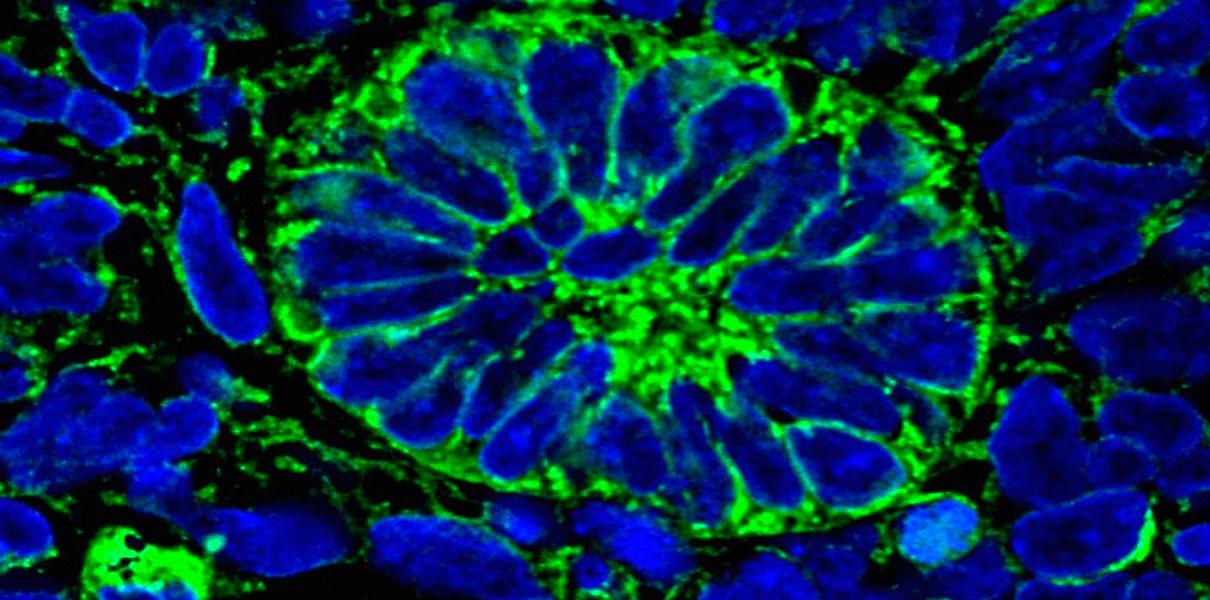 Ученые вырастили функциональные ткани почек
