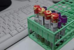 Бладкоины для «Третьего мнения»