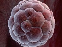 Стволовые клетки против ожогов глаз