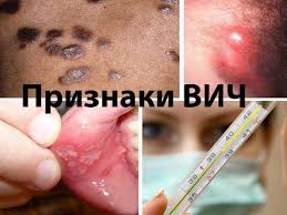 Объявление о приеме статей и тезисов на научно-практическую Конференцию «Актуальные вопросы диагностики, лечения и профилактики ВИЧ-инфекции» Объявление о приеме статей и тезисов на научно-практическую Конференцию «Актуальные вопросы диагностики, лечения и профилактики ВИЧ-инфекции»