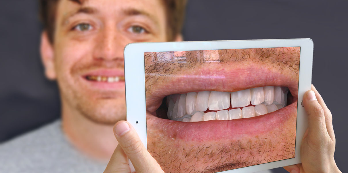 Стартап хочет принести дополненную реальность в кабинеты стоматологов