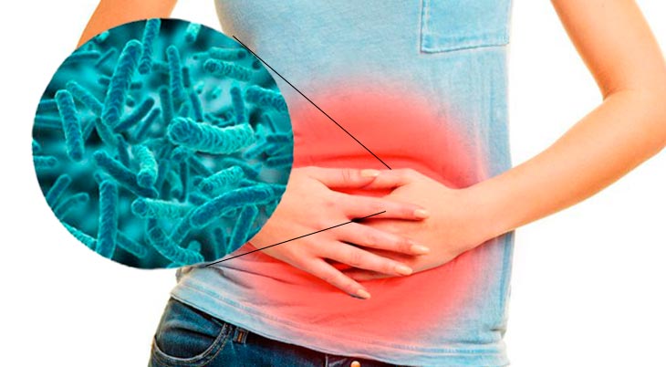 6 признаков нарушения микрофлоры кишечника