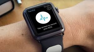 Apple Watch будет определять нарушения сердечного ритма