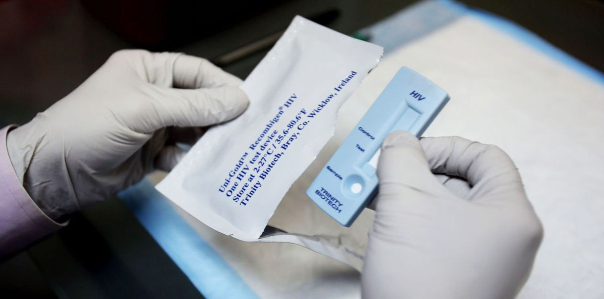 Разработан новый метод диагностики ВИЧ на ранних стадиях Разработан новый метод диагностики ВИЧ на ранних стадиях