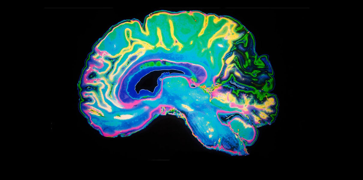 Лекарство от Альцгеймера обращает вспять клеточные часы