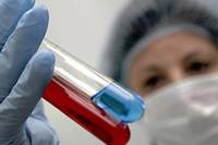 Проведена гепатошкола в рамках II съезда инфекционистов Узбекистана