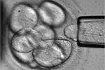 Ученые превратили стволовые клетки в клетки поджелудочной железы