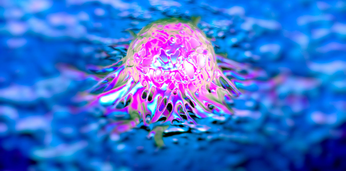 Найден способ «отключать» устойчивость рака к лекарствам