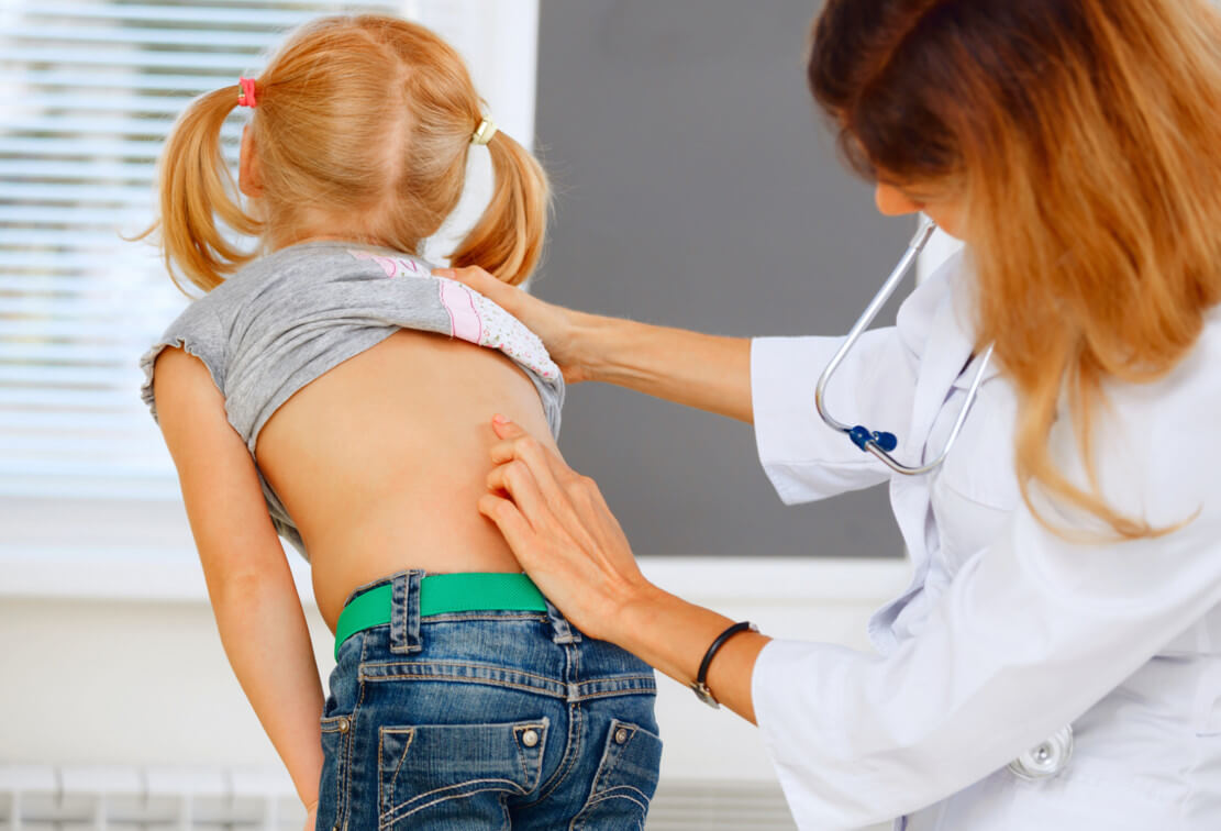 Как предотвратить сколиоз у ребенка?
