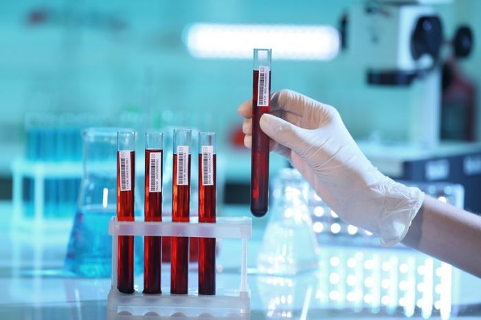 Ростех и Siemens создадут в России сеть клинико-диагностических лабораторий