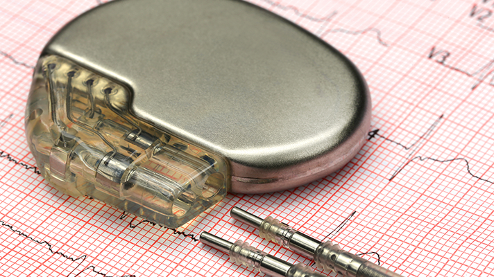 Pacemaker-HITN712_1.png