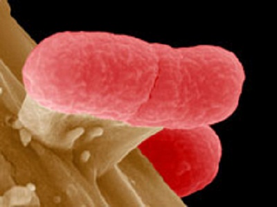 Во Франции детей на больничную койку отправили гамбургеры с E.coli